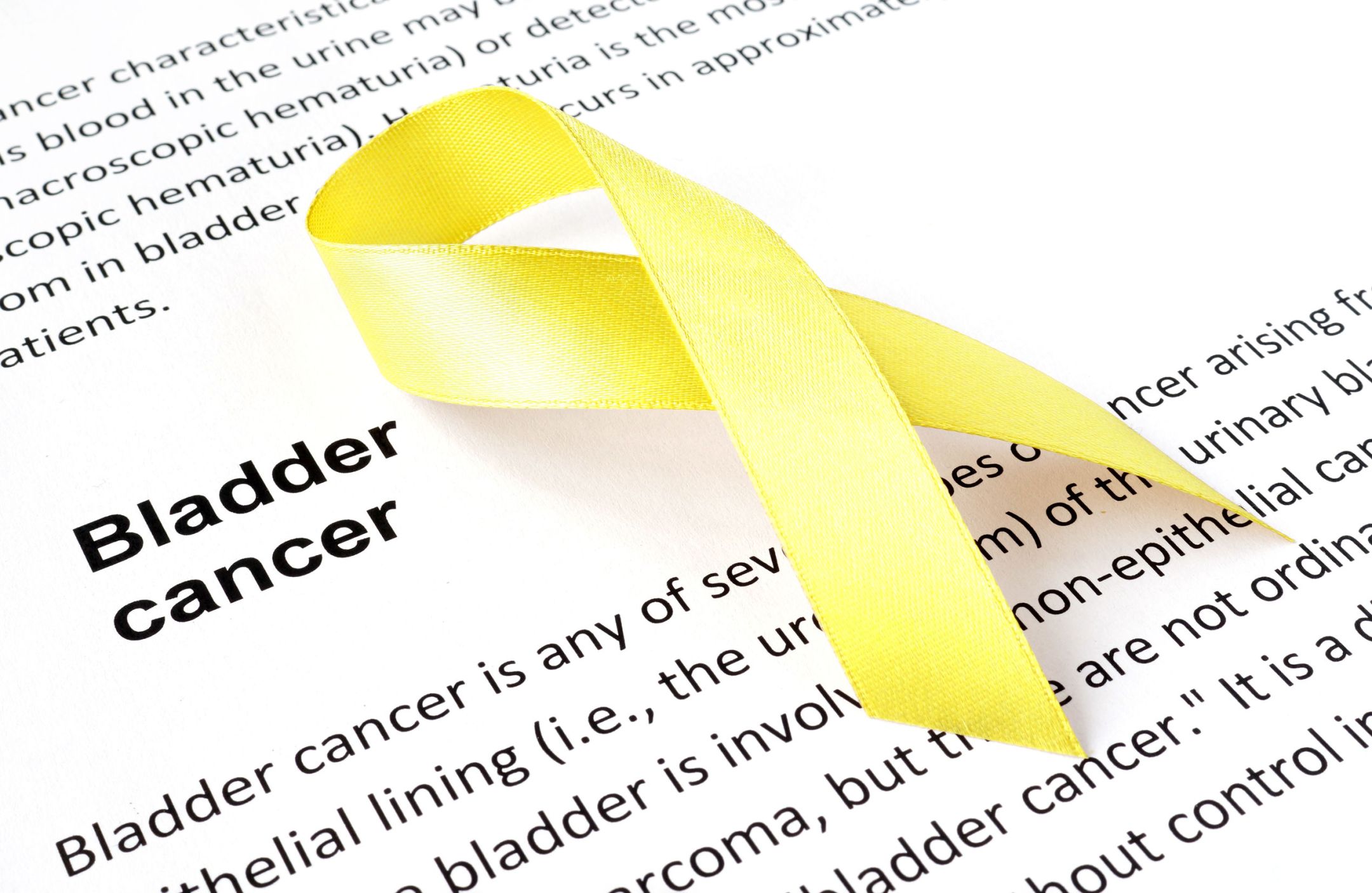 Авелумаб одобрен для пациентов с уротелиальным раком | Новости | GxP News